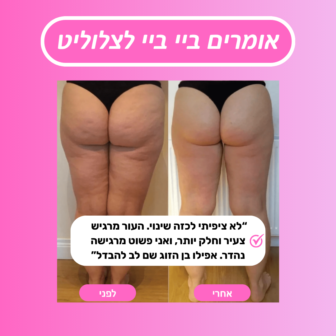 ™Relevo Roller - רולר צלוליט למראה עור חלק ובריא יותר ב־5 דק׳ ביום