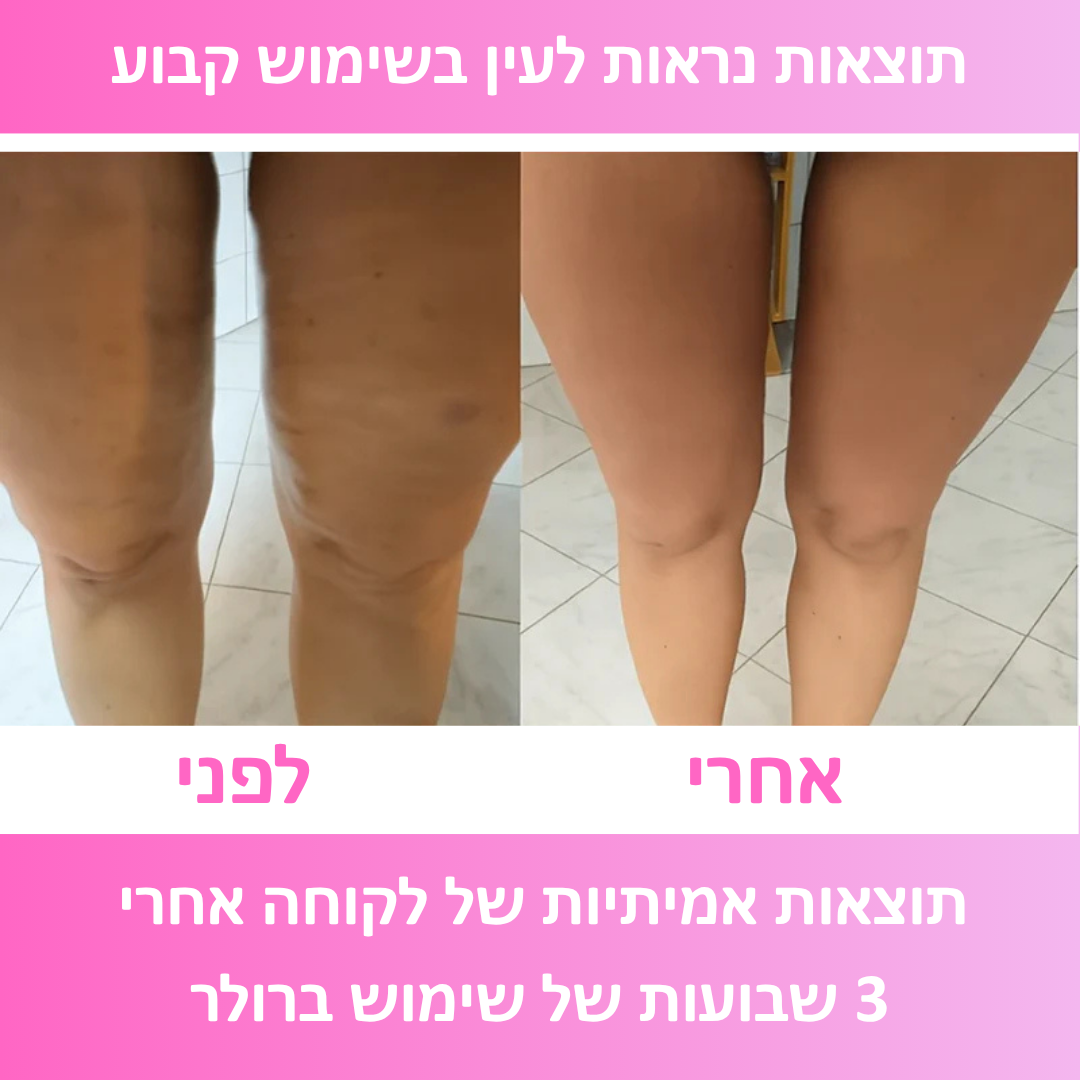 ™Relevo Roller - רולר צלוליט למראה עור חלק ובריא יותר ב־5 דק׳ ביום